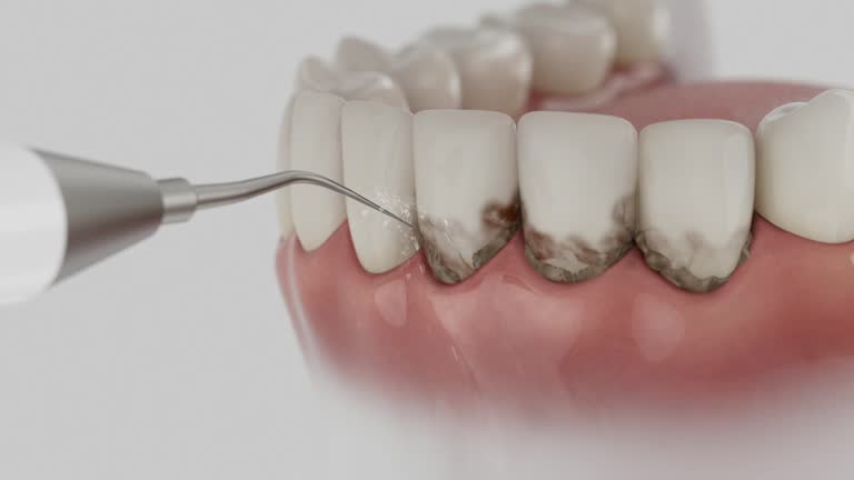 Reliable Dental Implants contractor in Navassa, NC by Smile Center Dentistry